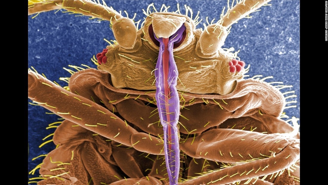 bedbugcalgary JAPCO Pest Control Ltd.